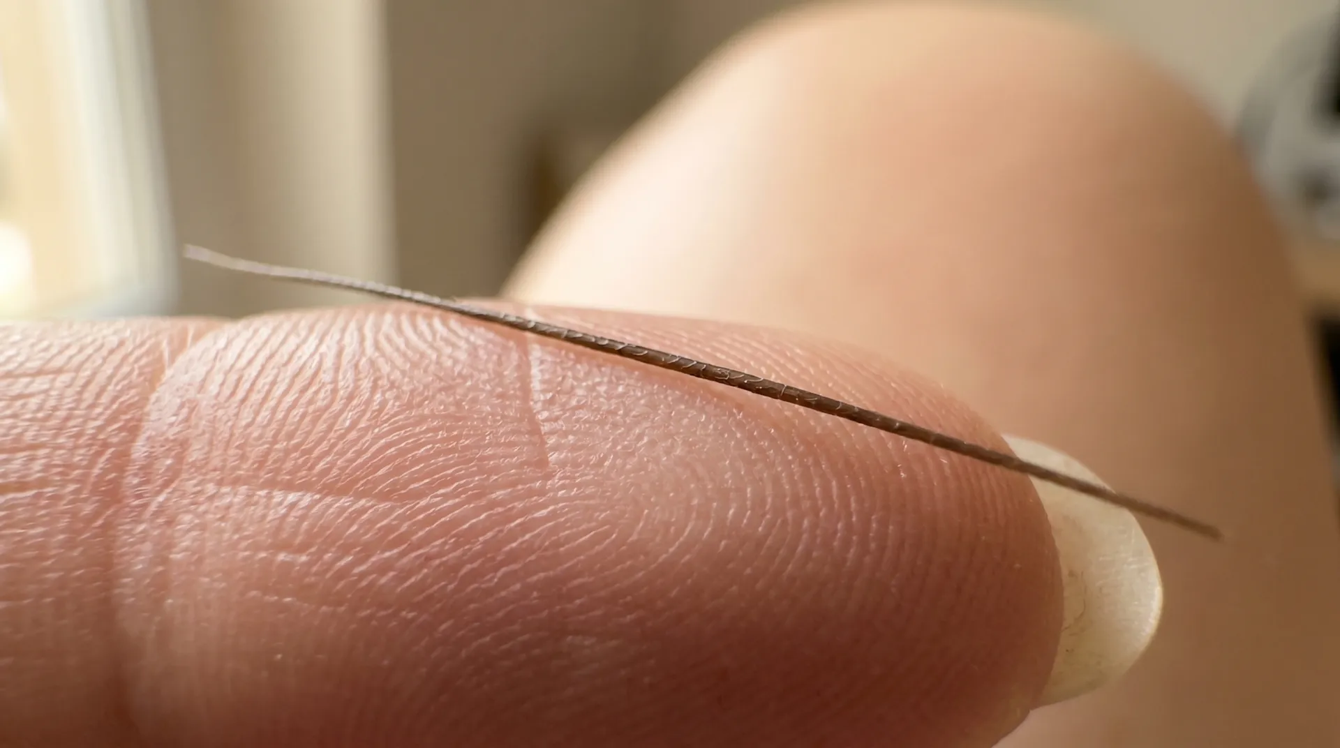 Mikroskopbild av hårfollikel och nagelmatris